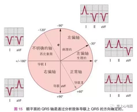 逆時針|逆時針心軸轉位：正常嗎？需要治療嗎？